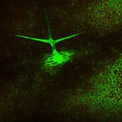 Fluorescence image of an Arabidopsis leaf. This plant is expressing the GFP gene from the trichome specific GL2 promoter. Note that the GFP fluorescence diffuses out of the trichome cell.